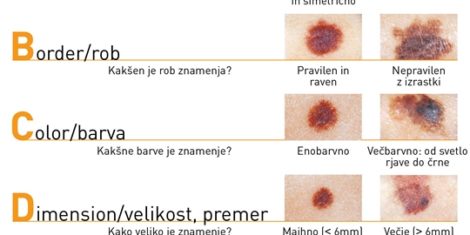 ABCDE-pregledovanja