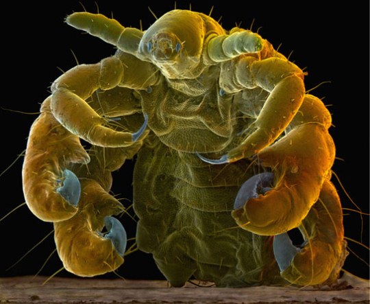 Pubic-Louse-Phthirus-pubis-sramna-us