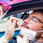 PCR-testiranje-Stozice-narocanje-telefonska-stevilka-drive-in