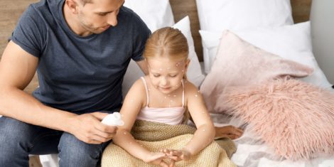 Norice niso zgolj otroška bolezen, saj ko zboli družina, trpi tudi gospodarstvo