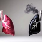 Število žensk s pljučnim rakom v Sloveniji se je v 15 letih skoraj podvojilo